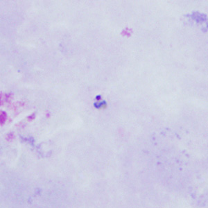 June - 2015 - Case #398