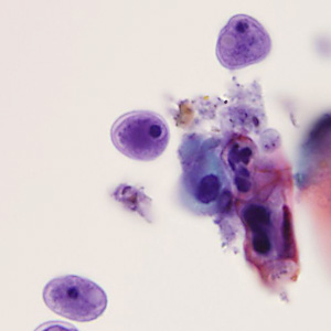 October - 2015 - Case #405