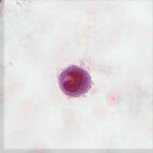 October - 2015 - Case #406