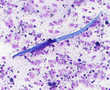 November - 2015 - Case #407