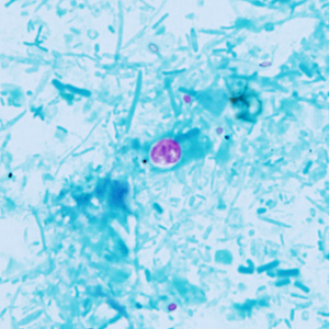 December - 2015 - Case #409