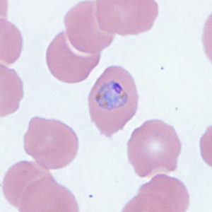 December - 2015 - Case #410