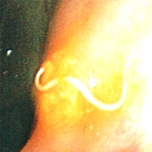 Case411_B.jpg Figure B