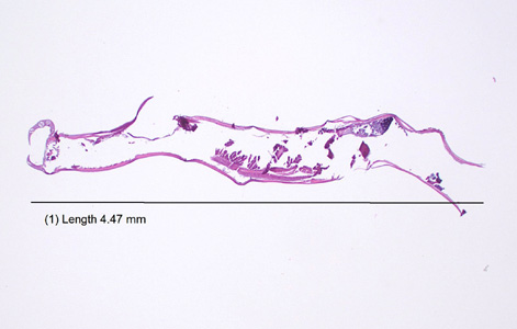 Case411_C.jpg Figure C