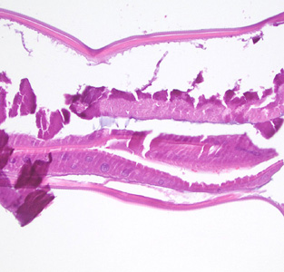 Case411_D.jpg Figure D