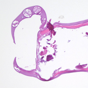 Case411_E.jpg Figure E