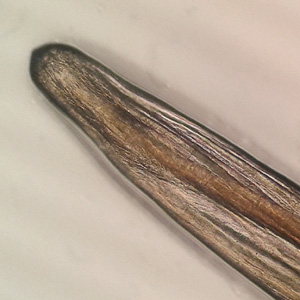 Case412_B.jpg Figure B