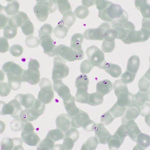 Case413_D.jpg Figure D