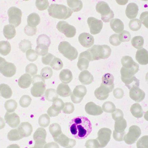 Case413_E.jpg Figure E