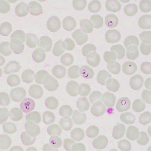 Case413_F.jpg Figure F