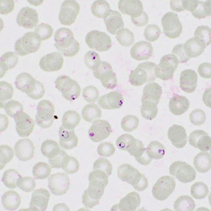 Case413_G.jpg Figure G