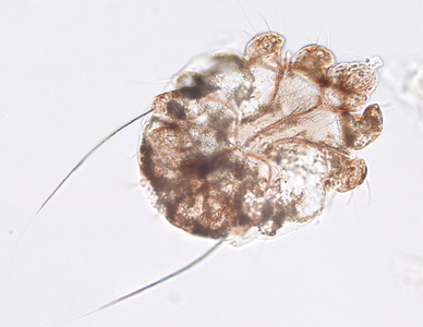 March - 2016 - Case #416