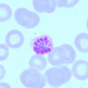 April - 2016 - Case #418