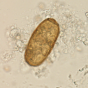 May - 2016 - Case #420