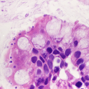 September - 2016 - Case #428