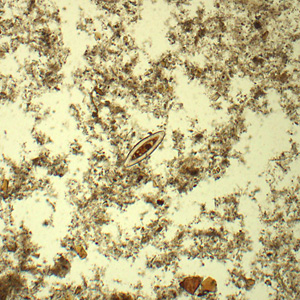 December - 2016 - Case #433