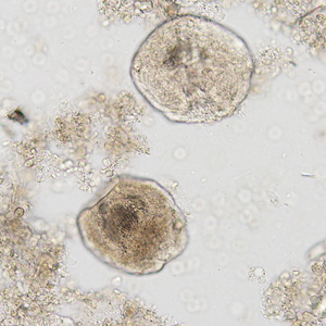 MAY - 2017 - Case #444 Case444