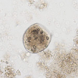 Case444_C Case Image