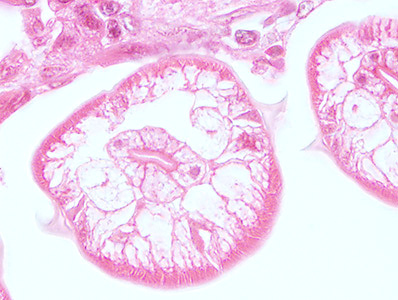 Case448_C parasitic image
