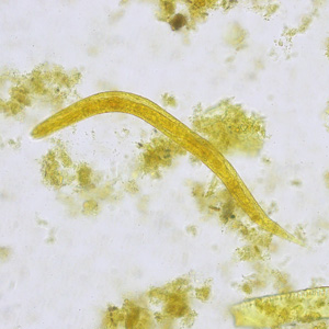 Case450_A parasitic image