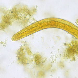 Case450_B parasitic image