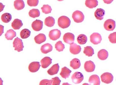 Case453_A parasitic image