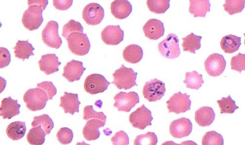 Case453_B parasitic image