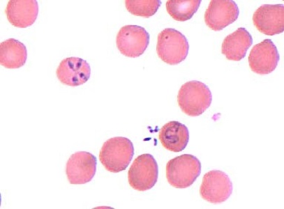 Case453_C parasitic image