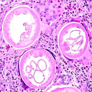 Case454_A parasitic image