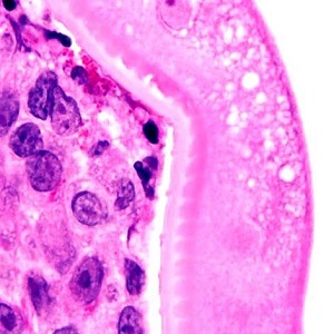 Case454_E parasitic image