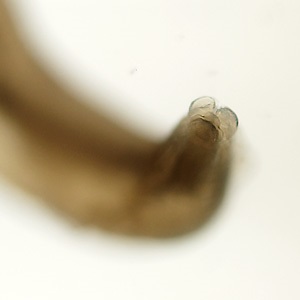 Case455_B Parasitic image