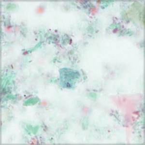 Case456_B parasitic image