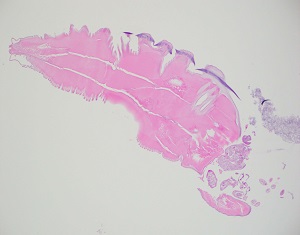 Case458_A parasitic image