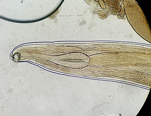 AUGUST - 2018 - CASE #473 parasitic image