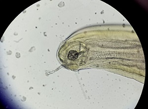 Case 473_B parasitic image