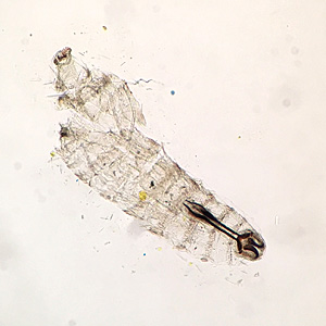 Case459_A parasitic image