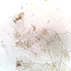 Case459_B parasitic image