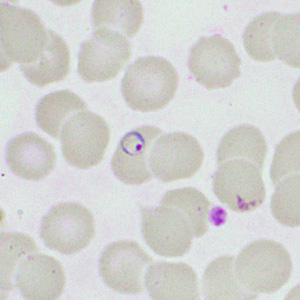 Case460_C parasitic image