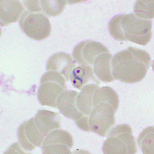 Case460_E parasitic image