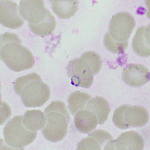 Case460_I parasitic image