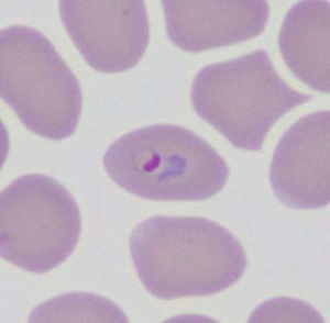 Case461_C Parasitic image