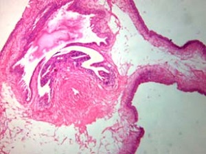 FEBRUARY - 2018 - Case #462 Parasitic image