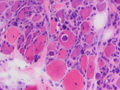 Case463_D Parasitic image