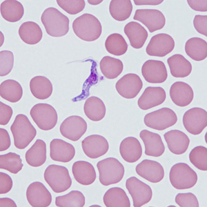 Case464_C Parasitic image