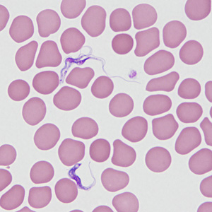 Case464_D Parasitic image