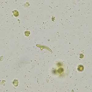 MAY - 2018 - Case #467 Parasitic image