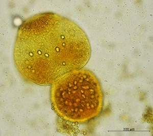 OLYMPUS DIGITAL CAMERA Parasitic image