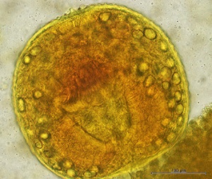 OLYMPUS DIGITAL CAMERA Parasitic image