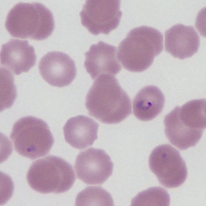 Case469_A Parasitic image