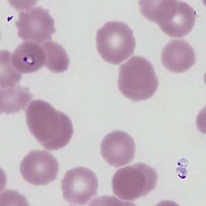 Case469_B Parasitic image